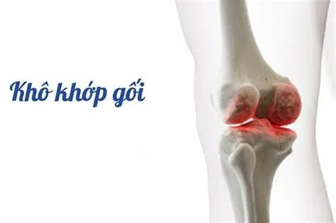 Cách Phòng Ngừa Khô Khớp? Bí Quyết Cho Khớp Luôn Dẻo Dai